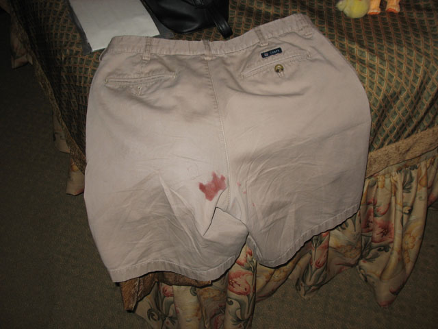 Pant Mishap!